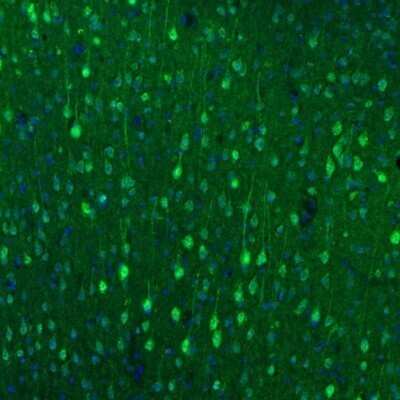 Immunohistochemistry: alpha-N-acetylglucosaminidase/NAGLU Antibody [NBP1-82601]