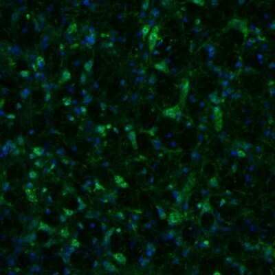 Immunohistochemistry: alpha-N-acetylglucosaminidase/NAGLU Antibody [NBP1-82601]