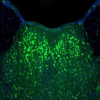 Immunohistochemistry: alpha-N-acetylglucosaminidase/NAGLU Antibody [NBP1-82601]
