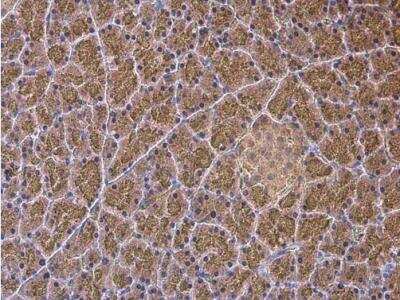 Immunohistochemistry-Paraffin: alpha-N-acetylglucosaminidase/NAGLU Antibody [NBP1-31555]