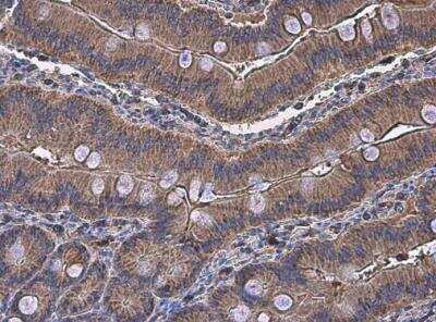Immunohistochemistry-Paraffin: alpha-N-acetylglucosaminidase/NAGLU Antibody [NBP1-31555]