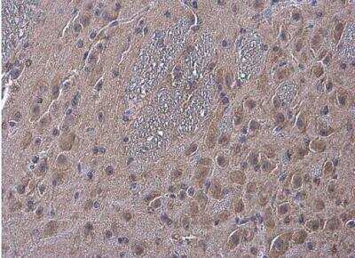 Immunohistochemistry-Paraffin: alpha-N-acetylglucosaminidase/NAGLU Antibody [NBP1-31555]