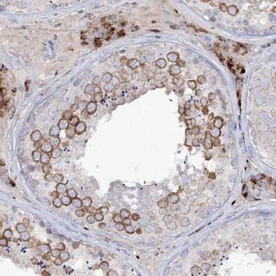 Immunohistochemistry-Paraffin: alpha-N-acetylglucosaminidase/NAGLU Antibody [NBP1-82601]