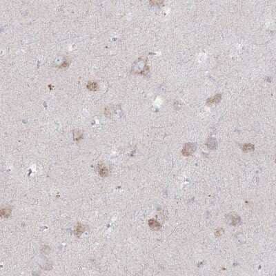 Immunohistochemistry-Paraffin: alpha-N-acetylglucosaminidase/NAGLU Antibody [NBP1-82601]