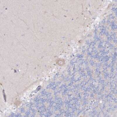 Immunohistochemistry-Paraffin: alpha-N-acetylglucosaminidase/NAGLU Antibody [NBP1-82601]
