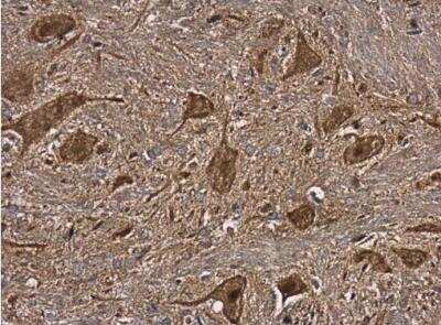 Immunohistochemistry-Paraffin: alpha-N-acetylglucosaminidase/NAGLU Antibody [NBP2-19465]