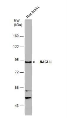 Western Blot: alpha-N-acetylglucosaminidase/NAGLU Antibody [NBP2-19465]