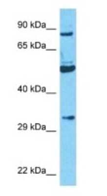 Western Blot: alpha-N-acetylglucosaminidase/NAGLU Antibody [NBP3-10653]