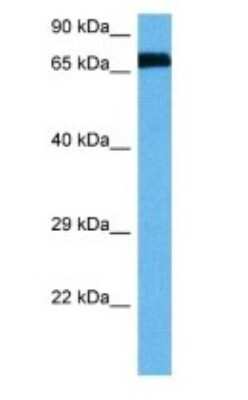 Western Blot: alpha-N-acetylglucosaminidase/NAGLU Antibody [NBP3-10800]