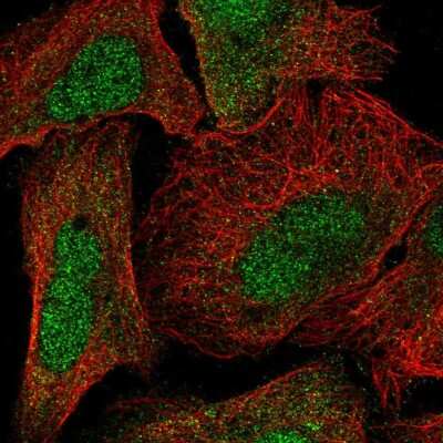 Immunocytochemistry/ Immunofluorescence: alpha-N-terminal Methyltransferase 1A/METTL11A Antibody [NBP2-58554]