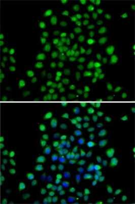 Immunocytochemistry/ Immunofluorescence: alpha-N-terminal Methyltransferase 1A/METTL11A Antibody - BSA Free [NBP2-92670]