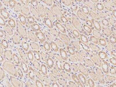 Immunohistochemistry-Paraffin: alpha-N-terminal Methyltransferase 1A/METTL11A Antibody [NBP3-12704]