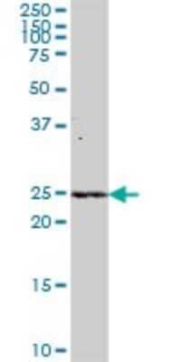 Western Blot: alpha-N-terminal Methyltransferase 1A/METTL11A Antibody [H00028989-B01P]