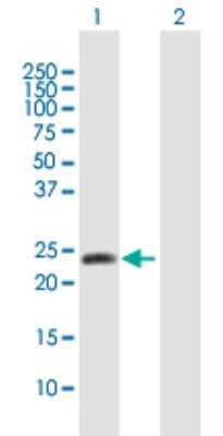 Western Blot: alpha-N-terminal Methyltransferase 1A/METTL11A Antibody [H00028989-B01P]