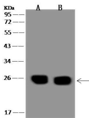 Western Blot: alpha-N-terminal Methyltransferase 1A/METTL11A Antibody [NBP3-12704]