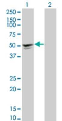 Western Blot: alpha-Sarcoglycan Antibody (3C4) [H00006442-M01]