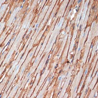 Immunohistochemistry-Paraffin: alpha-Sarcoglycan Antibody (3W3Q10) [NBP3-15896]