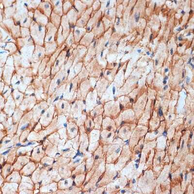Immunohistochemistry-Paraffin: alpha-Sarcoglycan Antibody (3W3Q10) [NBP3-15896]