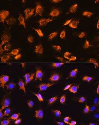 Immunocytochemistry/ Immunofluorescence: alpha-Sarcoglycan Antibody - Azide and BSA Free [NBP2-92438]