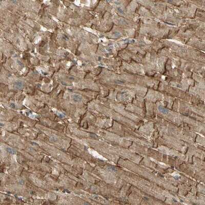 Immunohistochemistry-Paraffin: alpha-Sarcoglycan Antibody [NBP1-90306]