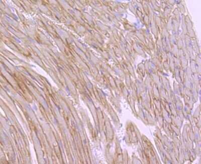 Immunohistochemistry-Paraffin: alpha-Sarcoglycan Antibody (JA51-81) [NBP2-67150]