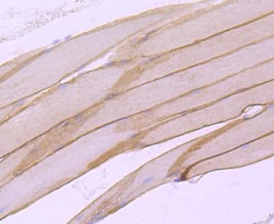 Immunohistochemistry-Paraffin: alpha-Sarcoglycan Antibody (JA51-81) [NBP2-67150]