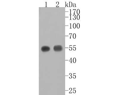 Western Blot: alpha-Sarcoglycan Antibody (JA51-81) [NBP2-67150]