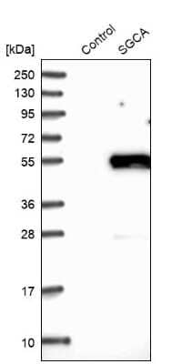 Western Blot: alpha-Sarcoglycan Antibody [NBP1-90306]