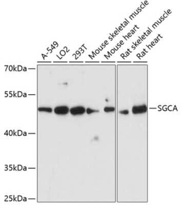 Western Blot: alpha-Sarcoglycan AntibodyAzide and BSA Free [NBP2-92438]