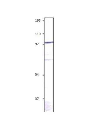 Western Blot: alpha-Sarcoglycan Antibody [NBP3-12370]