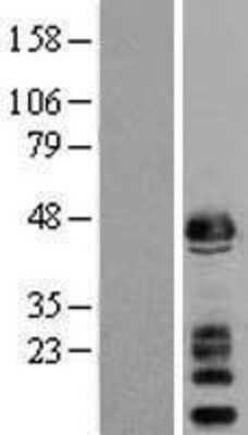 Western Blot: alpha-Sarcoglycan Overexpression Lysate [NBL1-15902]