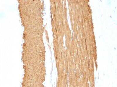 Immunohistochemistry-Paraffin: alpha-Smooth Muscle Actin Antibody (1A4 + ACTA2/791) - Azide and BSA Free [NBP2-47699]