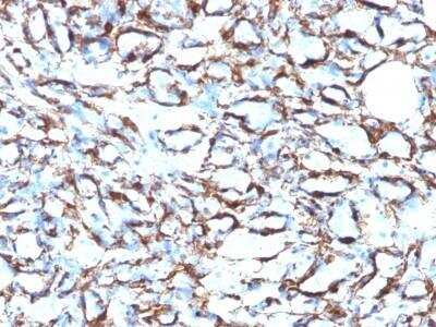 Immunohistochemistry-Paraffin: alpha-Smooth Muscle Actin Antibody (1A4 + ACTA2/791) - Azide and BSA Free [NBP2-47699]