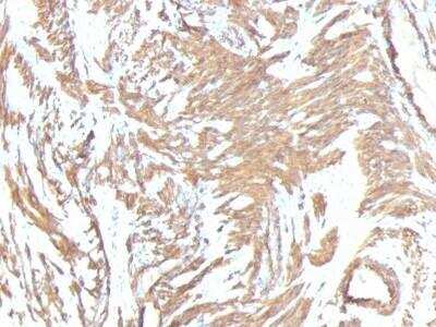 Immunohistochemistry-Paraffin: alpha-Smooth Muscle Actin Antibody (1A4 + ACTA2/791) - Azide and BSA Free [NBP2-47699]