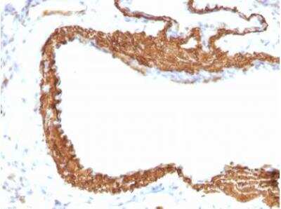 Immunohistochemistry-Paraffin: alpha-Smooth Muscle Actin Antibody (1A4 + ACTA2/791) - IHC-Prediluted [NBP2-48157]