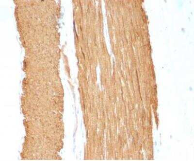 Immunohistochemistry-Paraffin: alpha-Smooth Muscle Actin Antibody (1A4 + ACTA2/791) - IHC-Prediluted [NBP2-48157]