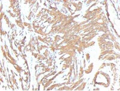 Immunohistochemistry-Paraffin: alpha-Smooth Muscle Actin Antibody (1A4 + ACTA2/791) - IHC-Prediluted [NBP2-48157]