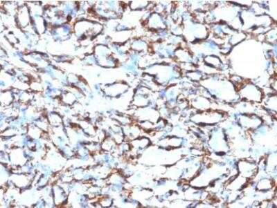 Immunohistochemistry-Paraffin: alpha-Smooth Muscle Actin Antibody (1A4 + ACTA2/791) - IHC-Prediluted [NBP2-48157]