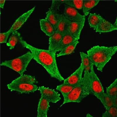 Immunocytochemistry/ Immunofluorescence: alpha-Smooth Muscle Actin Antibody (1A4 + ACTA2/791) [NBP2-44464]