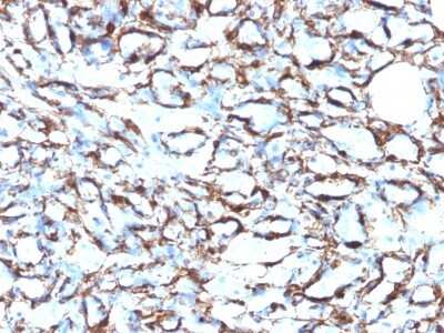 Immunohistochemistry-Paraffin: alpha-Smooth Muscle Actin Antibody (1A4 + ACTA2/791) [NBP2-44464]