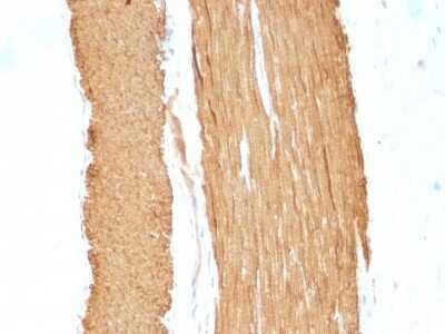 Immunohistochemistry-Paraffin: alpha-Smooth Muscle Actin Antibody (1A4 + ACTA2/791) [NBP2-44464]