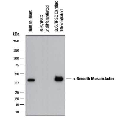 Western Blot Detection of alpha-Smooth Muscle Actin in Human Heart Tissue and iBJ6 hiPSCs