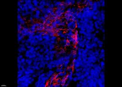 Immunohistological Staining of alpha-Smooth Muscle Actin in Frozen Human Tonsil