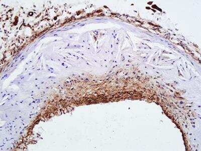 Immunohistochemistry-Frozen: alpha-Smooth Muscle Actin Antibody (4A4) - BSA Free [NBP2-22120]