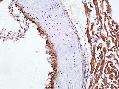 Immunohistochemistry-Frozen: alpha-Smooth Muscle Actin Antibody (4A4) - BSA Free [NBP2-22120]