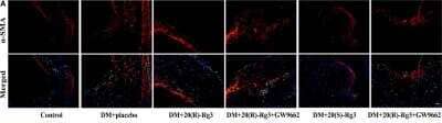 Immunohistochemistry: alpha-Smooth Muscle Actin Antibody (4A4) - BSA Free [NBP2-22120]