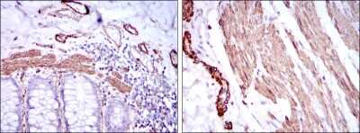 Immunohistochemistry-Paraffin: alpha-Smooth Muscle Actin Antibody (4A4) - BSA Free [NBP2-22120]