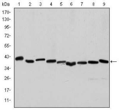 Western Blot: alpha-Smooth Muscle Actin Antibody (4A4)BSA Free [NBP2-22120]