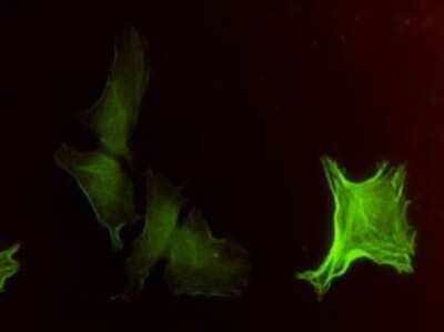 Immunocytochemistry/ Immunofluorescence: alpha-Smooth Muscle Actin Antibody (4A8-2H3) [H00000059-M02]