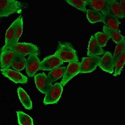 Immunocytochemistry/ Immunofluorescence: alpha-Smooth Muscle Actin Antibody (ACTA2/791) - Azide and BSA Free [NBP2-47698]